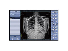 Software Rayence